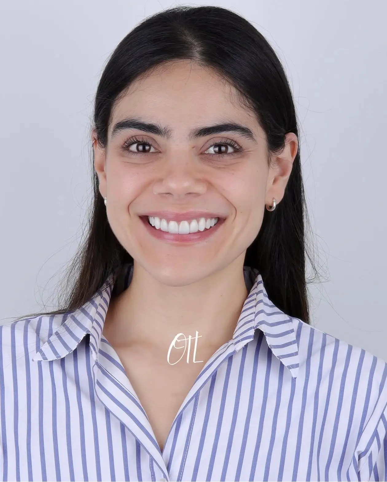 Paciente sonriendo con naturalidad